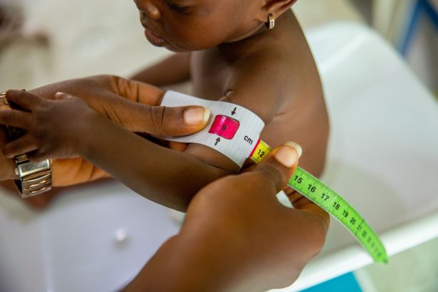 Profissional de saúde mede o braço de uma criança com fita antropométrica para avaliar seu estado nutricional.